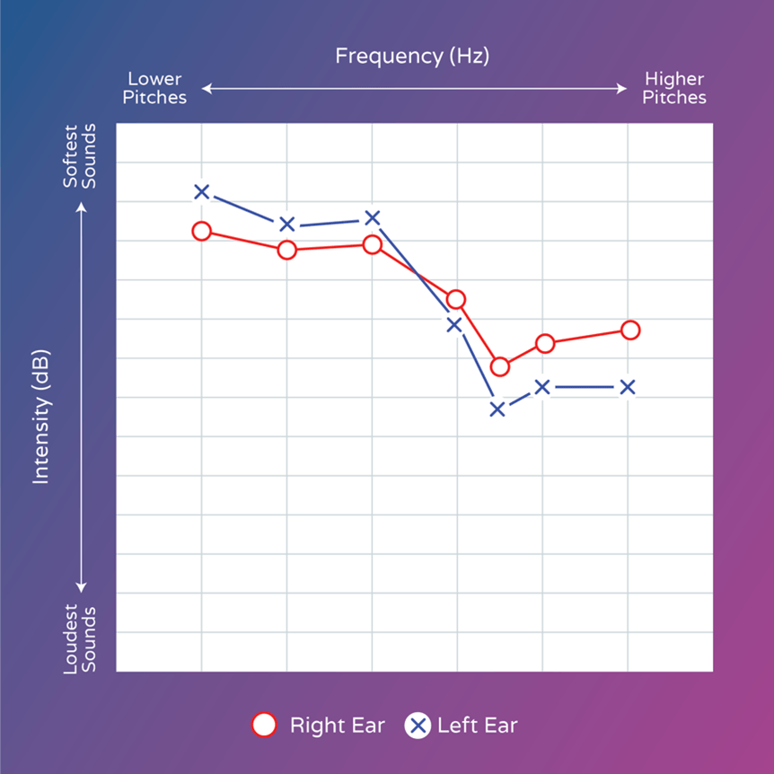 How to visualize hearing loss Discover Hearing